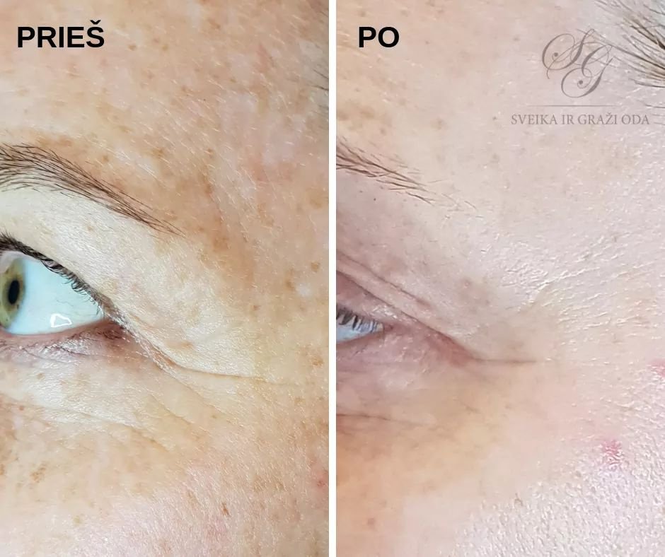 Grožio salonai, kirpyklos, soliariumai Kosmetologo paslaugos visai šeimai