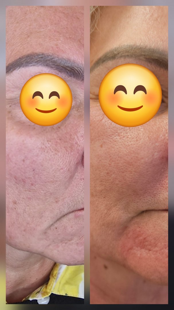 Grožio salonai, kirpyklos, soliariumai Kosmetologo paslaugos visai šeimai