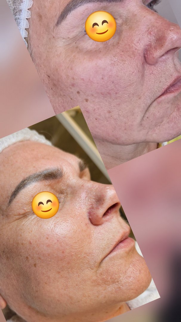 Grožio salonai, kirpyklos, soliariumai Kosmetologo paslaugos visai šeimai